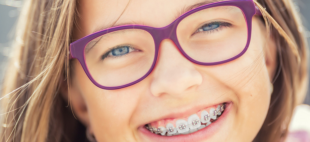 A girl smiling with glasses and braces.